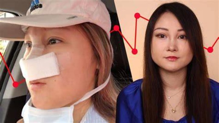Cherry White Before Surgery Pics, Age Height And Net Worth Revealed