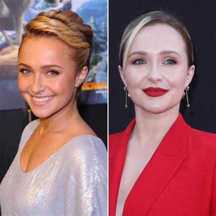 Did Hayden Panettiere Get Her Lips Done? Plastic Surgery Before And After Photos