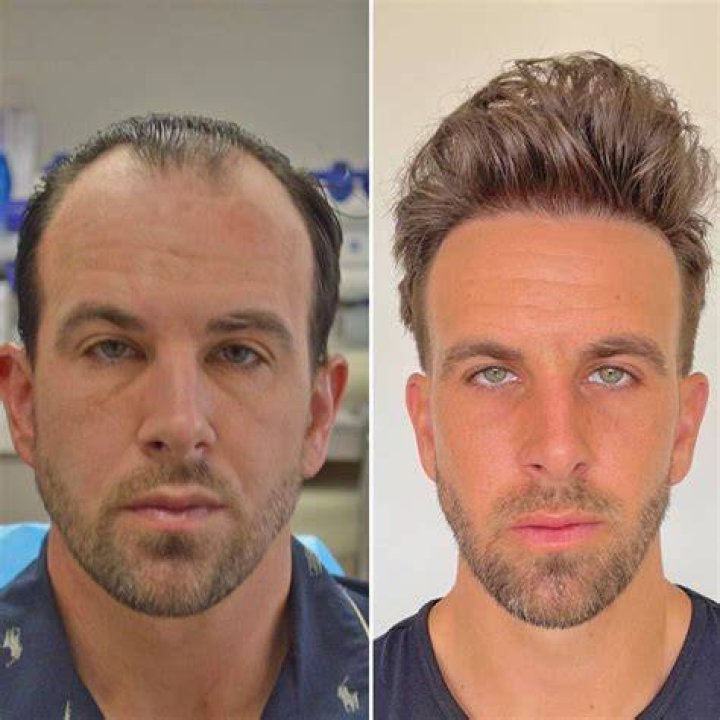 Did Mark Womack Get A Hair Transplant Surgery? The Responder Cast Hair Treatment Rumors Explored