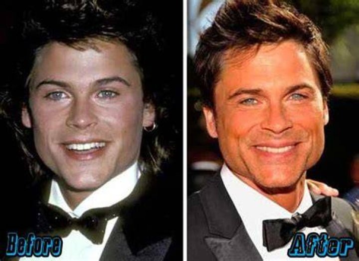 Did Rob Lowe Get Plastic Surgery On His Face? Here’s the Truth!