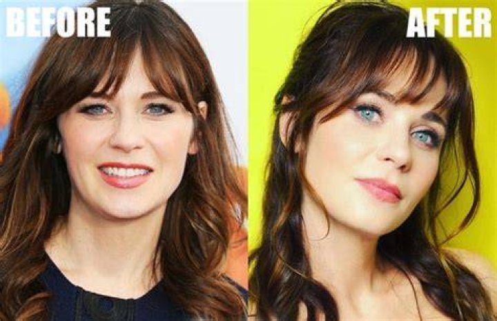 
Did Zooey Deschanel Get A Plastic Surgery? Facts Behind The Rumors 