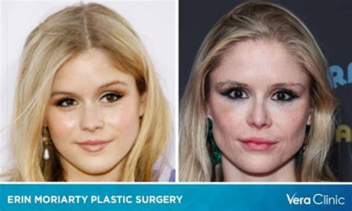 Does Erin Moriarty Have Eating Disorder? Illness And health Update, Plastic Surgery Before And After