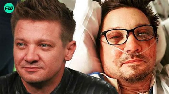 
Jeremy Renner leg updates: Hawkeye star reveals number of broken bones amid online amputation fears 