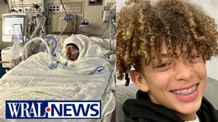 Mason Dark GoFundMe raises more than $18,000 after TikTok challenge leaves Wake Forest teen with 80% burns