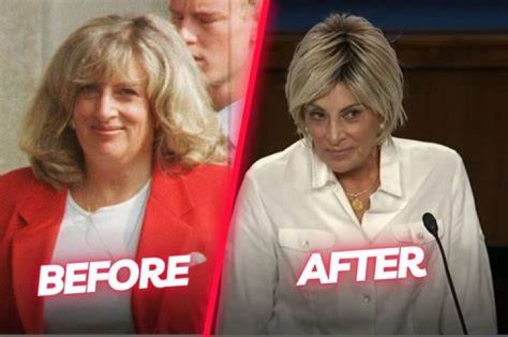 The Truth About Linda Tripp’s Plastic Surgery