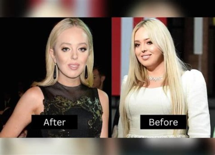 Tiffany Trump Weight Loss And Transformation: Before And After Picture- Diet And Workout Plan