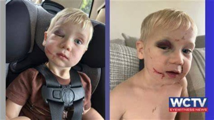 
Who Is Hadley Palmer From Greenwich CT? Arrested For Child Abuse, Photos And Videos On Reddit 